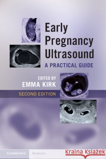 Early Pregnancy Ultrasound: A Practical Guide  9781009519021 Cambridge University Press - książka