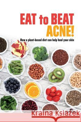 Eat to Beat Acne!: How a plant-based diet can help heal your skin. Matthews, Leigh 9780992022426 Nhp Publishing - książka