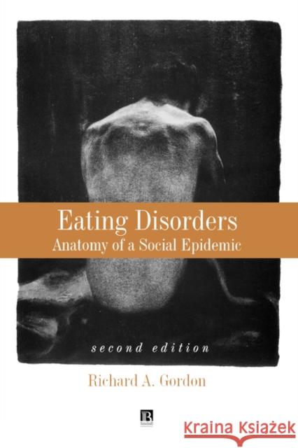 Eating Disorders: Anatomy of a Social Epidemic Gordon, Richard 9780631214960 Blackwell Publishers - książka