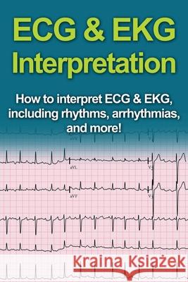 ECG & EKG Interpretation: How to interpret ECG & EKG, including rhythms, arrhythmias, and more! Jeremy Pine 9781761030987 Ingram Publishing - książka