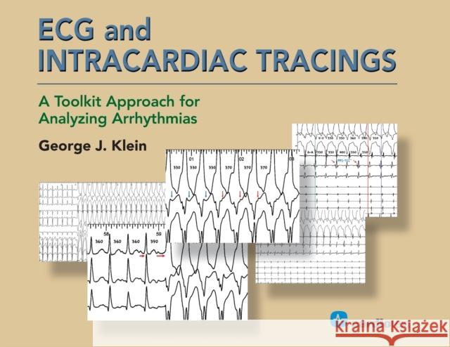 ECG and Intracardiac Tracings: A Toolkit Approach for Analyzing Arrhythmias George J. Klein 9781942909255 Cardiotext Inc - książka