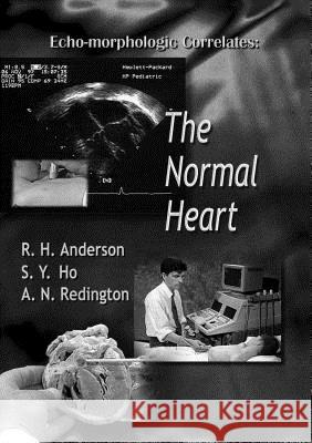 Echo-Morphologic Correlates: The Normal Heart (with Video) [With *] Robert H. Anderson S. Y. Ho Andrew Redington 9781860941108 World Scientific Publishing Company - książka