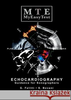 Echocardiography - MyEasyTest Felitti, Giuseppe 9780244317614 Lulu.com - książka