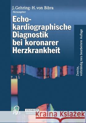 Echokardiographische Diagnostik Bei Koronarer Herzkrankheit J. Gehring Helene Von Bibra 9783642864742 Steinkopff-Verlag Darmstadt - książka