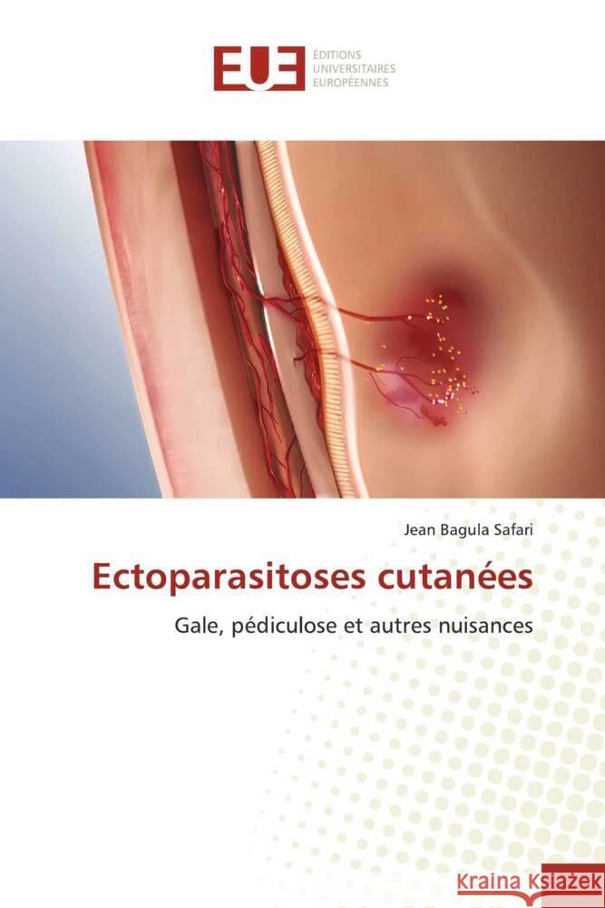 Ectoparasitoses cutanées Bagula Safari, Jean 9786138480273 Éditions universitaires européennes - książka