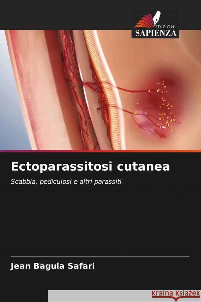 Ectoparassitosi cutanea Bagula Safari, Jean 9786205173541 Edizioni Sapienza - książka