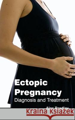 Ectopic Pregnancy: Diagnosis and Treatment Alex Bradley 9781632421210 Foster Academics - książka