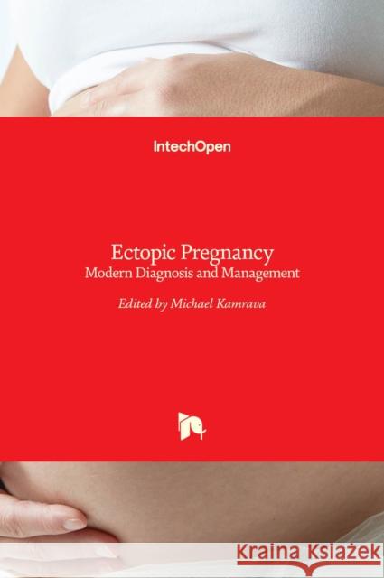 Ectopic Pregnancy: Modern Diagnosis and Management Michael Kamrava 9789533076485 Intechopen - książka