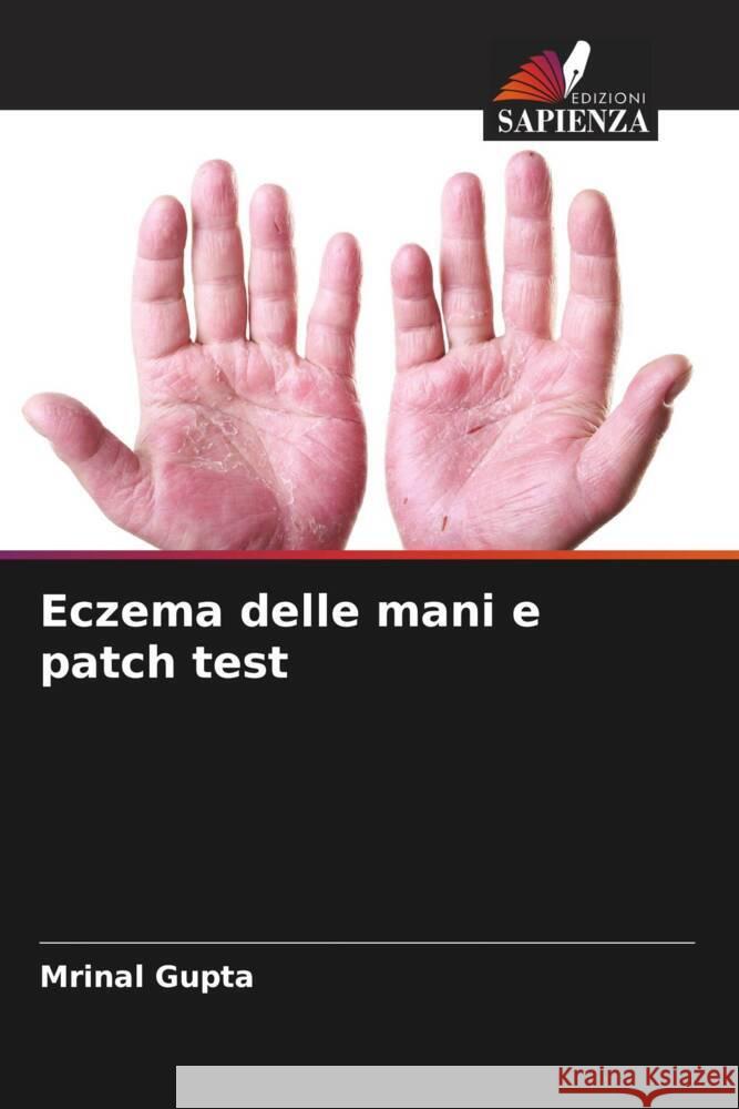 Eczema delle mani e patch test Gupta, Mrinal 9786205476673 Edizioni Sapienza - książka