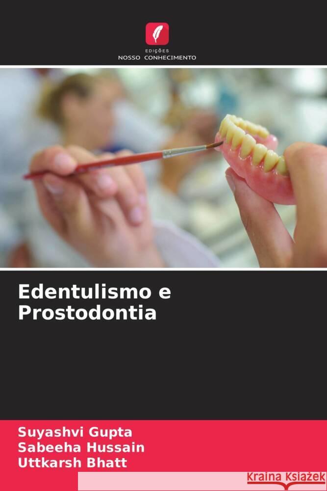 Edentulismo e Prostodontia Gupta, Suyashvi, Hussain, Sabeeha, Bhatt, Uttkarsh 9786205230619 Edições Nosso Conhecimento - książka