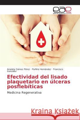 Efectividad del lisado plaquetario en úlceras posflebíticas Gámez Pérez Anadely, Hernández Porfirio, Gonzalez Francisco 9783639782530 Editorial Academica Espanola - książka