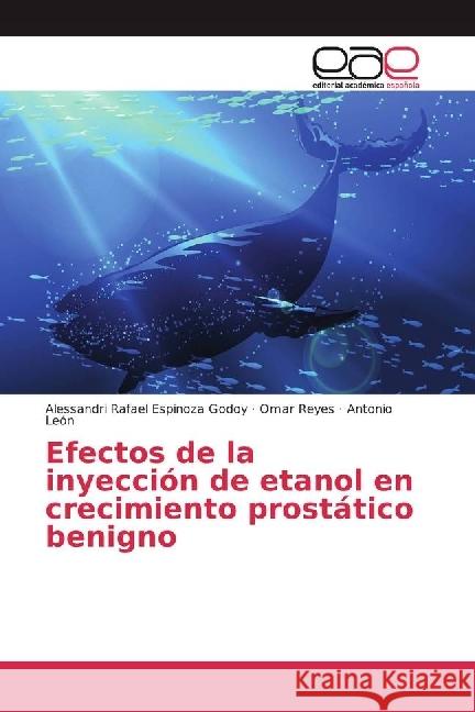 Efectos de la inyección de etanol en crecimiento prostático benigno Espinoza Godoy, Alessandri Rafael; Reyes, Omar; Leon, Antonio 9783639535891 Editorial Académica Española - książka