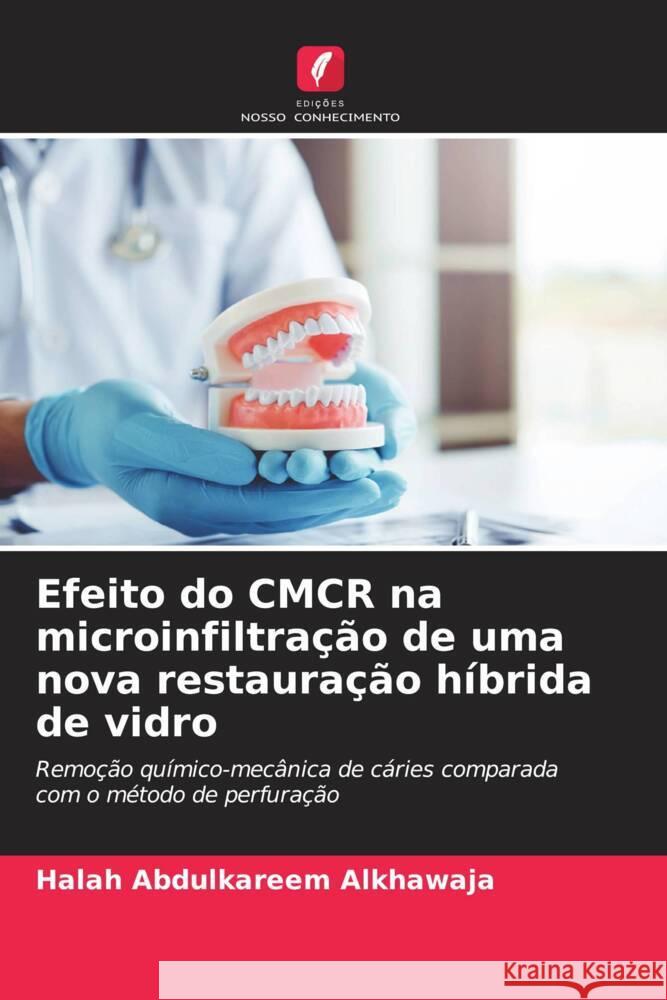 Efeito do CMCR na microinfiltra??o de uma nova restaura??o h?brida de vidro Halah Abdulkareem Alkhawaja 9786207241682 Edicoes Nosso Conhecimento - książka