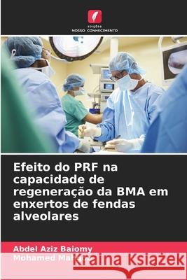 Efeito do PRF na capacidade de regenera??o da BMA em enxertos de fendas alveolares Abdel Aziz Baiomy Mohamed Mahgob 9786207517701 Edicoes Nosso Conhecimento - książka