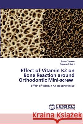 Effect of Vitamin K2 on Bone Reaction around Orthodontic Mini-screw Yaseen, Banan 9786200435033 LAP Lambert Academic Publishing - książka