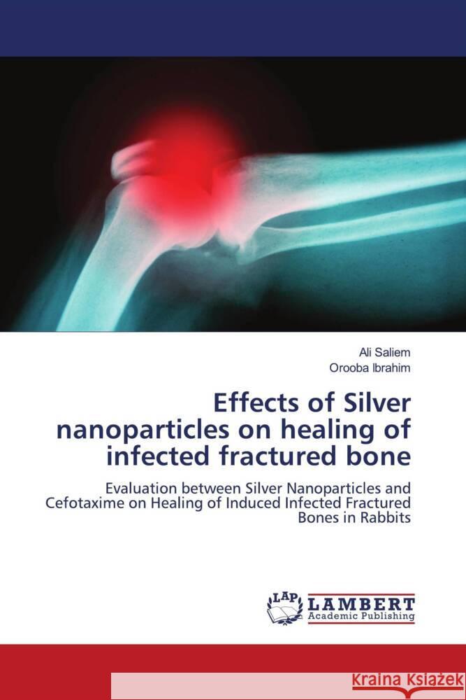 Effects of Silver nanoparticles on healing of infected fractured bone Saliem, Ali, Ibrahim, Orooba 9786203028621 LAP Lambert Academic Publishing - książka