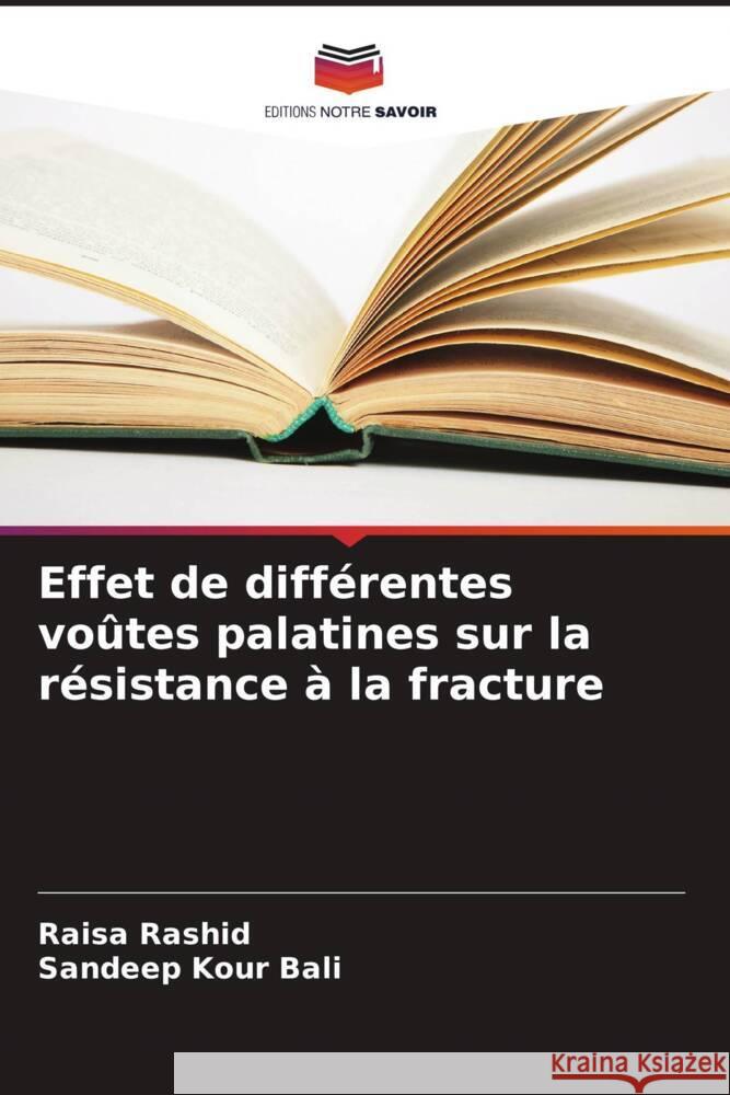 Effet de différentes voûtes palatines sur la résistance à la fracture Rashid, Raisa, Kour Bali, Sandeep 9786205117804 Editions Notre Savoir - książka