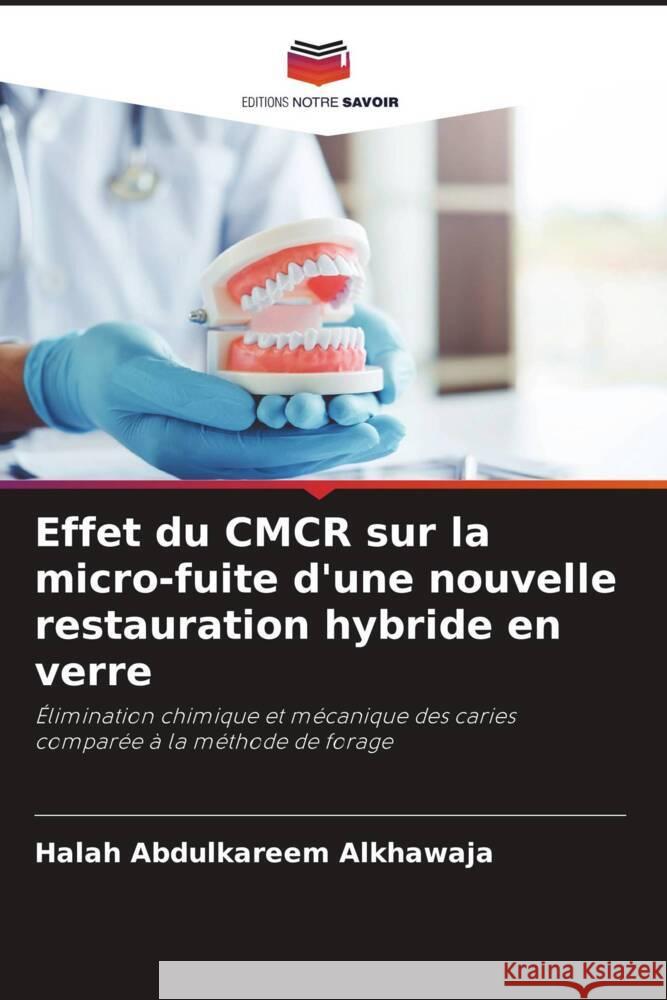 Effet du CMCR sur la micro-fuite d'une nouvelle restauration hybride en verre Halah Abdulkareem Alkhawaja 9786207241668 Editions Notre Savoir - książka