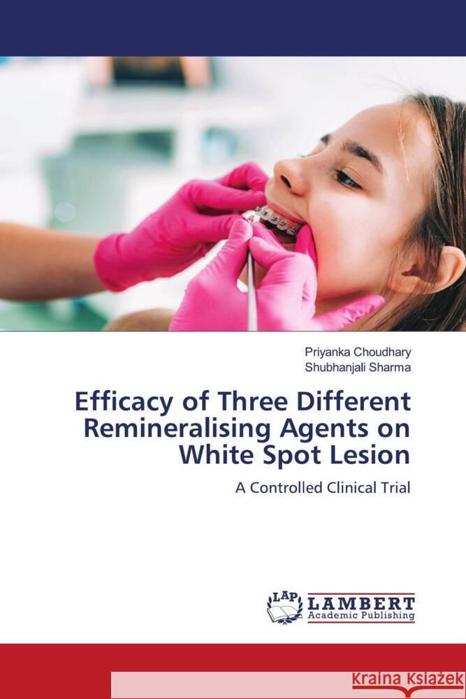 Efficacy of Three Different Remineralising Agents on White Spot Lesion Choudhary, Priyanka, Sharma, Shubhanjali 9786205529232 LAP Lambert Academic Publishing - książka