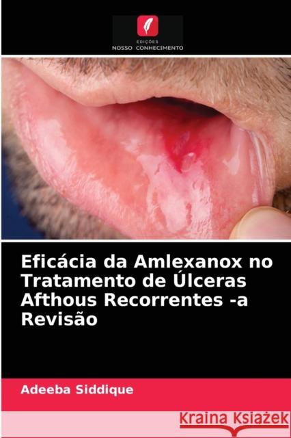 Eficácia da Amlexanox no Tratamento de Úlceras Afthous Recorrentes -a Revisão Adeeba Siddique 9786203347906 Edicoes Nosso Conhecimento - książka