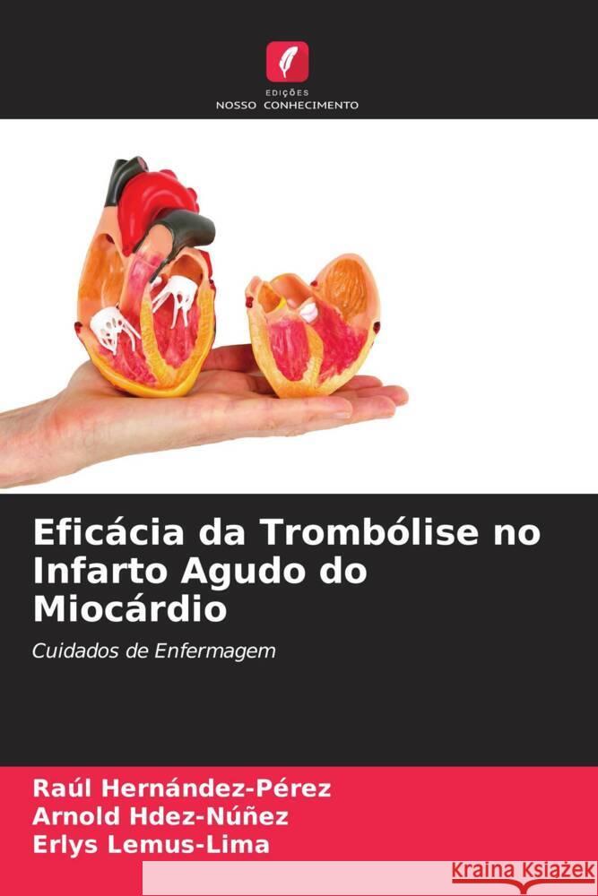 Eficácia da Trombólise no Infarto Agudo do Miocárdio Hernández-Pérez, Raúl, Hdez-Núñez, Arnold, Lemus-Lima, Erlys 9786206567387 Edições Nosso Conhecimento - książka