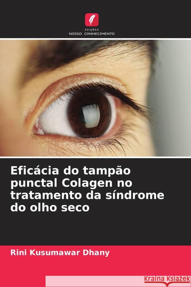 Efic?cia do tamp?o punctal Colagen no tratamento da s?ndrome do olho seco Rini Kusumawa 9786208108779 Edicoes Nosso Conhecimento - książka