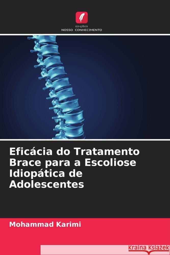 Eficácia do Tratamento Brace para a Escoliose Idiopática de Adolescentes Karimi, Mohammad 9786204582481 Edições Nosso Conhecimento - książka