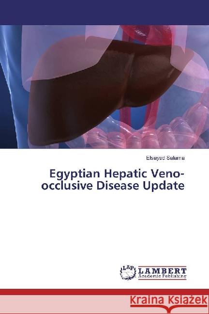 Egyptian Hepatic Veno-occlusive Disease Update Salama, Elsayed 9783330328075 LAP Lambert Academic Publishing - książka