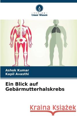 Ein Blick auf Geb?rmutterhalskrebs Ashok Kumar Kapil Avasthi 9786207863143 Verlag Unser Wissen - książka