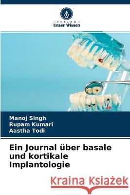 Ein Journal über basale und kortikale Implantologie Manoj Singh, Rupam Kumari, Aastha Todi 9786204126616 Verlag Unser Wissen - książka