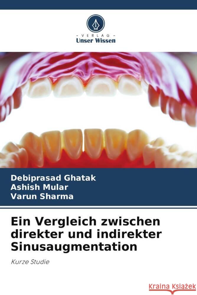 Ein Vergleich zwischen direkter und indirekter Sinusaugmentation Debiprasad Ghatak Ashish Mular Varun Sharma 9786207408955 Verlag Unser Wissen - książka