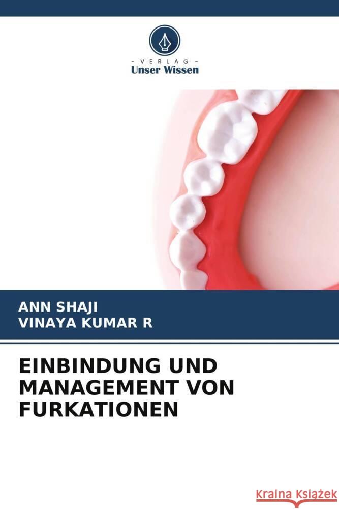 EINBINDUNG UND MANAGEMENT VON FURKATIONEN Shaji, Ann, KUMAR R, VINAYA 9786205207871 Verlag Unser Wissen - książka