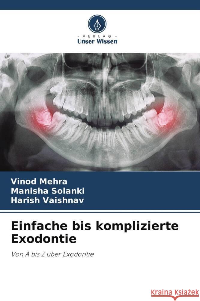 Einfache bis komplizierte Exodontie Mehra, Vinod, Solanki, Manisha, VAISHNAV, HARISH 9786207091591 Verlag Unser Wissen - książka