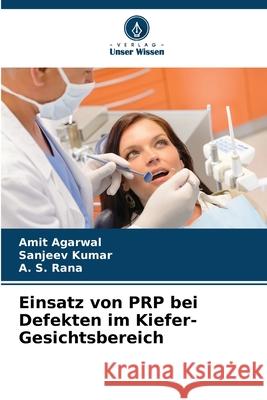 Einsatz von PRP bei Defekten im Kiefer-Gesichtsbereich Amit Agarwal Sanjeev Kumar A. S. Rana 9786207931033 Verlag Unser Wissen - książka