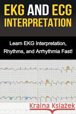 EKG and ECG Interpretation: Learn EKG Interpretation, Rhythms, and Arrhythmia Fast! Alyssa Stone 9781761031038 Ingram Publishing - książka