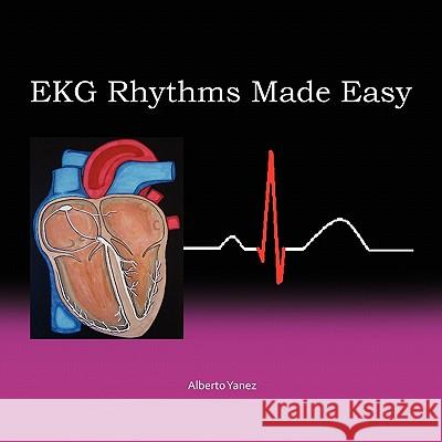 EKG Rhythms Made Easy Alberto Yanez 9781456843557 Xlibris Corporation - książka