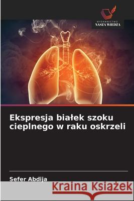 Ekspresja bialek szoku cieplnego w raku oskrzeli Abdija, Sefer 9786203573107 Wydawnictwo Nasza Wiedza - książka