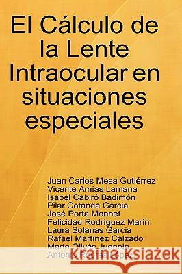 El Calculo De La Lente Intraocular En Situaciones Especiales Juan Carlos Mesa Gutierrez, Vicente Amias Lamana, Isabel Cabiro Badimon, Pilar Cotanda Garcia, Jose Porta Monnet, Laura  9781409240341 Lulu.com - książka