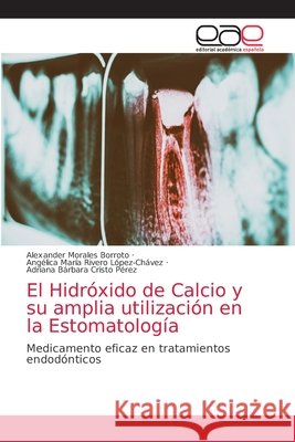 El Hidróxido de Calcio y su amplia utilización en la Estomatología Morales Borroto, Alexander 9786203033960 Editorial Academica Espanola - książka