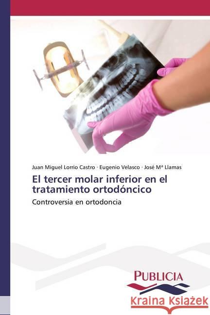 El tercer molar inferior en el tratamiento ortodóncico : Controversia en ortodoncia Lorrio Castro, Juan Miguel; Velasco, Eugenio; Llamas, José Mª 9786202430661 Publicia - książka