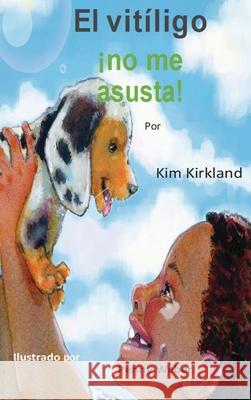 El vitiligo no me asusta Kim Kirkland 9798350728675 Asg Productions - książka