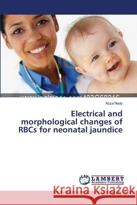 Electrical and morphological changes of RBCs for neonatal jaundice Nady, Azza 9783659438097 LAP Lambert Academic Publishing - książka