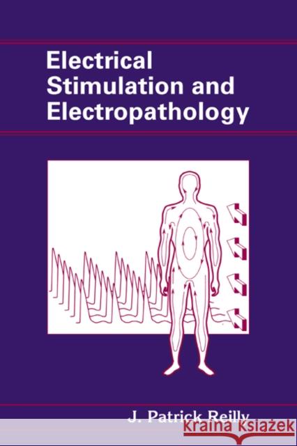 Electrical Stimulation and Electropathology J. Patrick Reilly Michael A. Chilbert James D. Sweeney 9780521417914 Cambridge University Press - książka