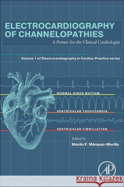 Electrocardiography of Channelopathies: A Primer for the Clinical Cardiologist Manlio F. M?rquez-Murillo 9780443223440 Elsevier Science Publishing Co Inc - książka