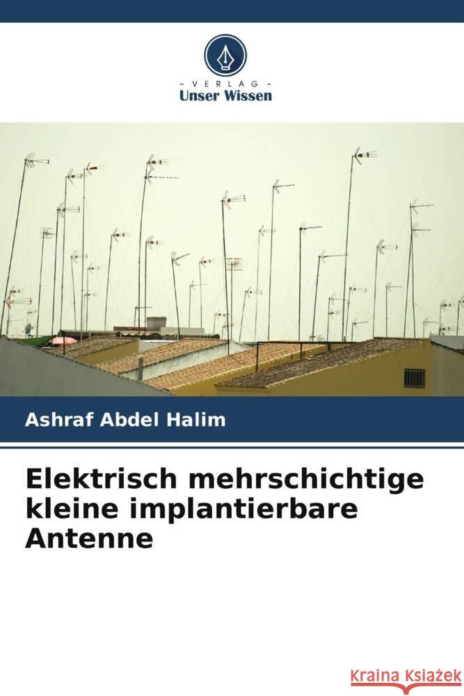 Elektrisch mehrschichtige kleine implantierbare Antenne Abdel Halim, Ashraf 9786204825588 Verlag Unser Wissen - książka