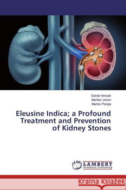 Eleusine Indica; a Profound Treatment and Prevention of Kidney Stones Amoah, Daniel; Joson, Maritan; Pareja, Marlon 9786134997195 LAP Lambert Academic Publishing - książka