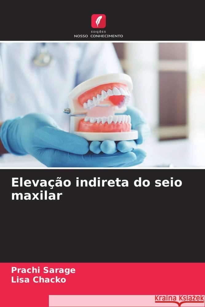 Elevação indireta do seio maxilar Sarage, Prachi, Chacko, Lisa 9786208611699 Edições Nosso Conhecimento - książka
