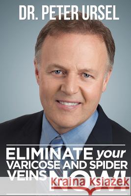 Eliminate Your Varicose and Spider Veins Now Dr Peter Ursel 9781490547152 Createspace - książka