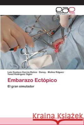 Embarazo Ectópico Gárcia Baños, Luis Gustavo 9783659082665 Editorial Academica Espanola - książka