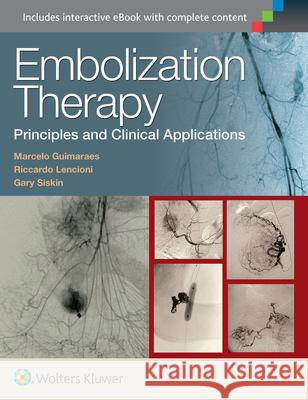 Embolization Therapy: Principles and Clinical Applications Marcelo Guimaraes Riccardo Lencioni Gary Siskin 9781451191448 Lww - książka